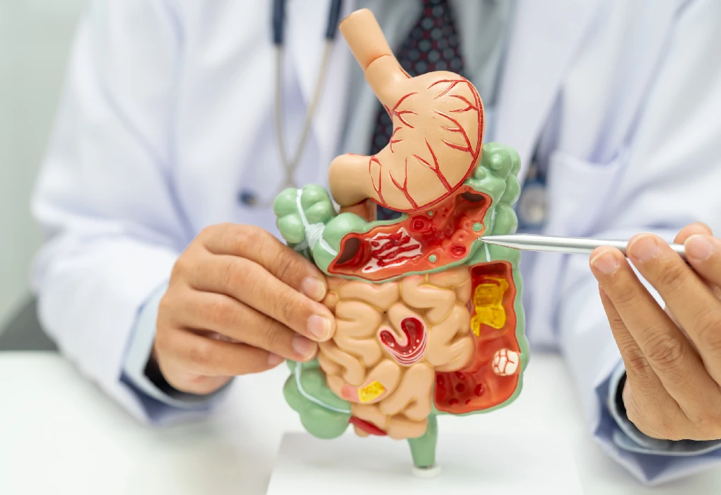 Increased Intestinal Permeability