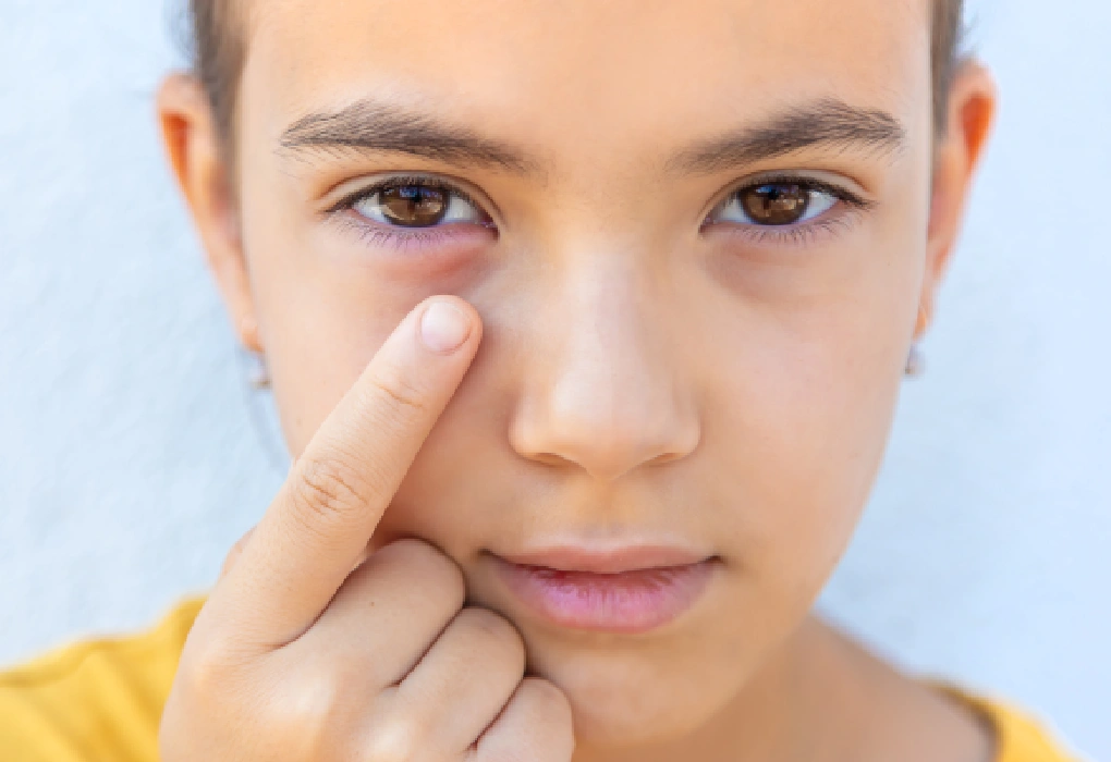 Protect You from an Eye Infection